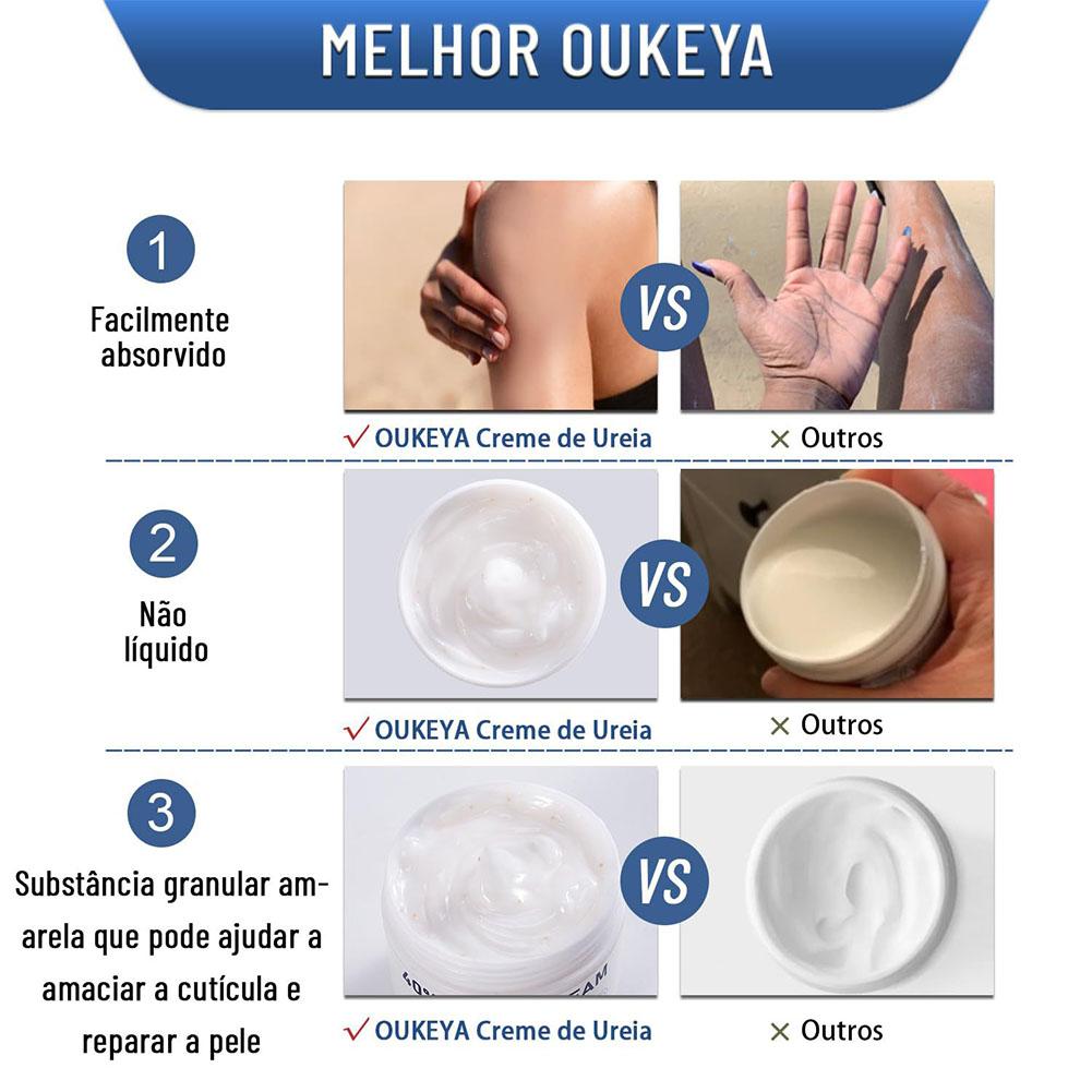 Urea-Creme 40% Feuchtigkeitssp – Urea Foot Cream Bewertung und Preis