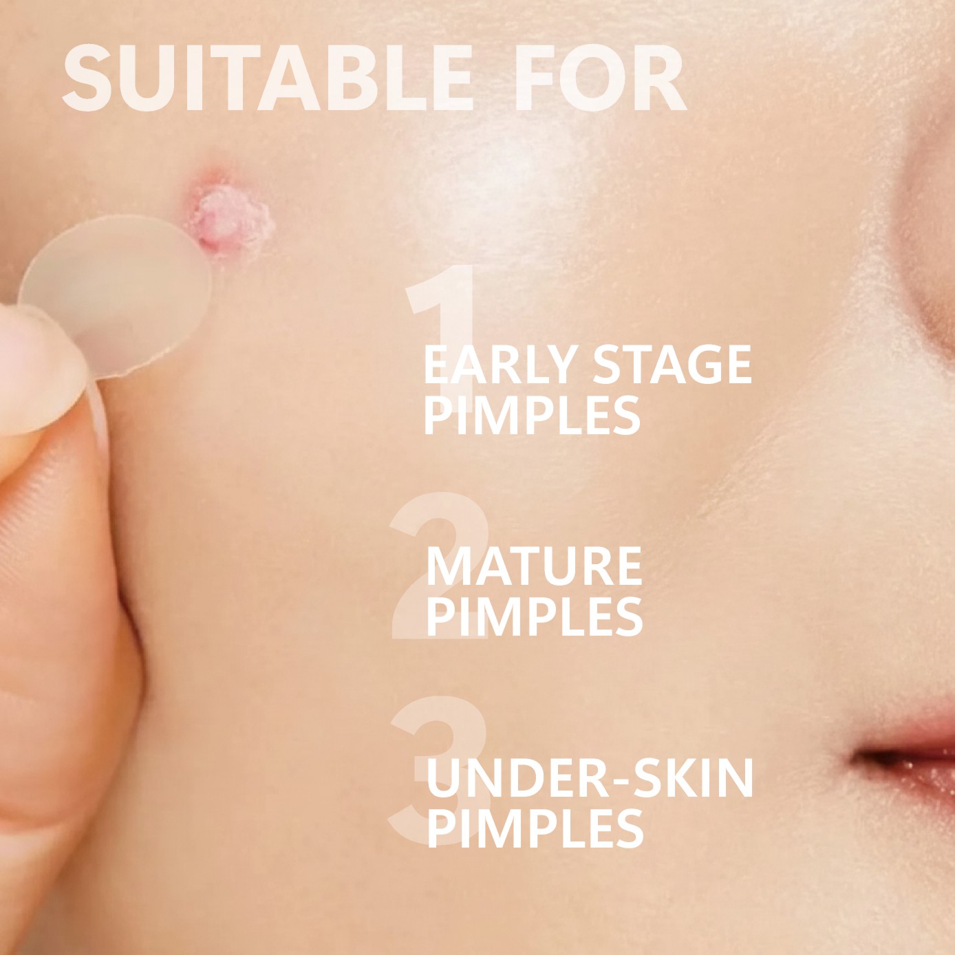 Mikronadel-Pickelpflaster (24e – Face Moisturizer Bewertung und Preis