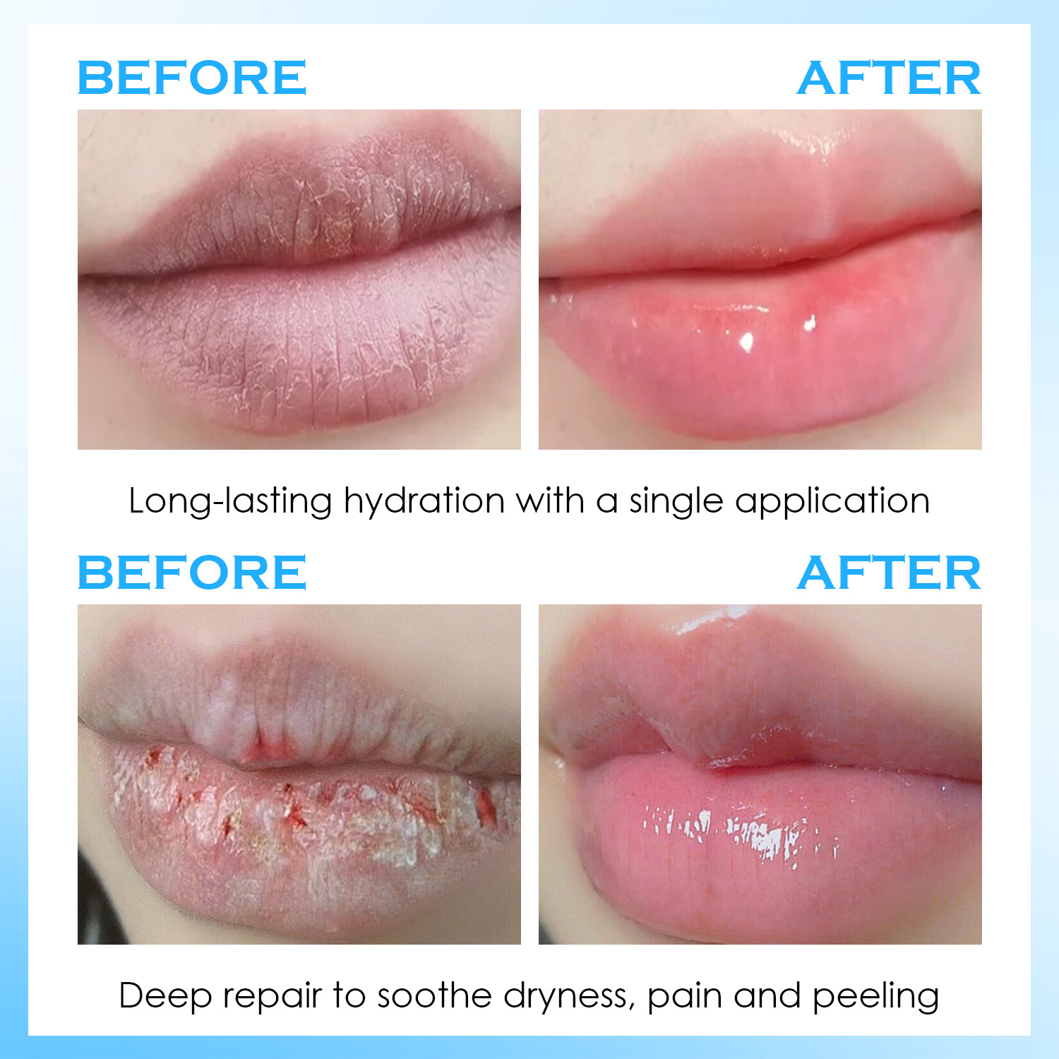 Lippen-Serum Feuchtigkeitsspen – Lip Balm Bewertung und Preis