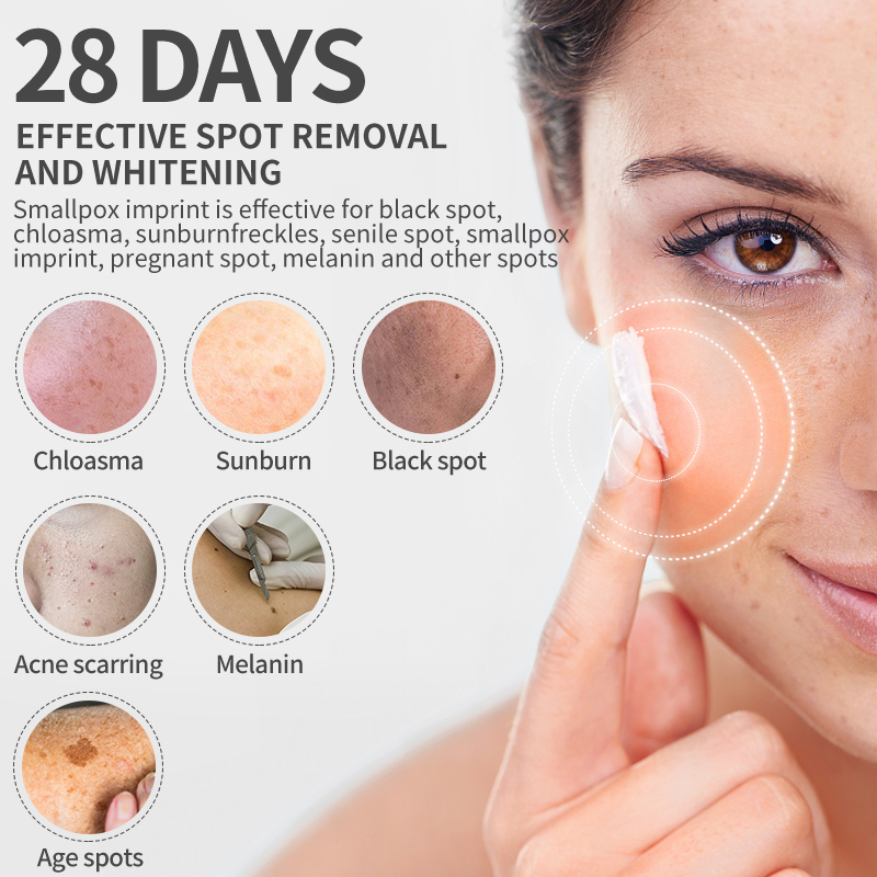 Dimollaure White ning Sommersp – Retinol Cream Bewertung und Preis