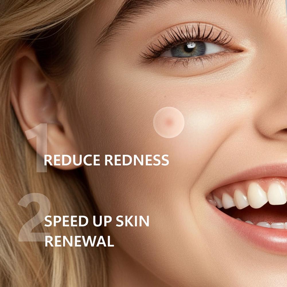 Unsichtbare Mikro-Nadel-Akne-P – Skincare China Bewertung und Preis