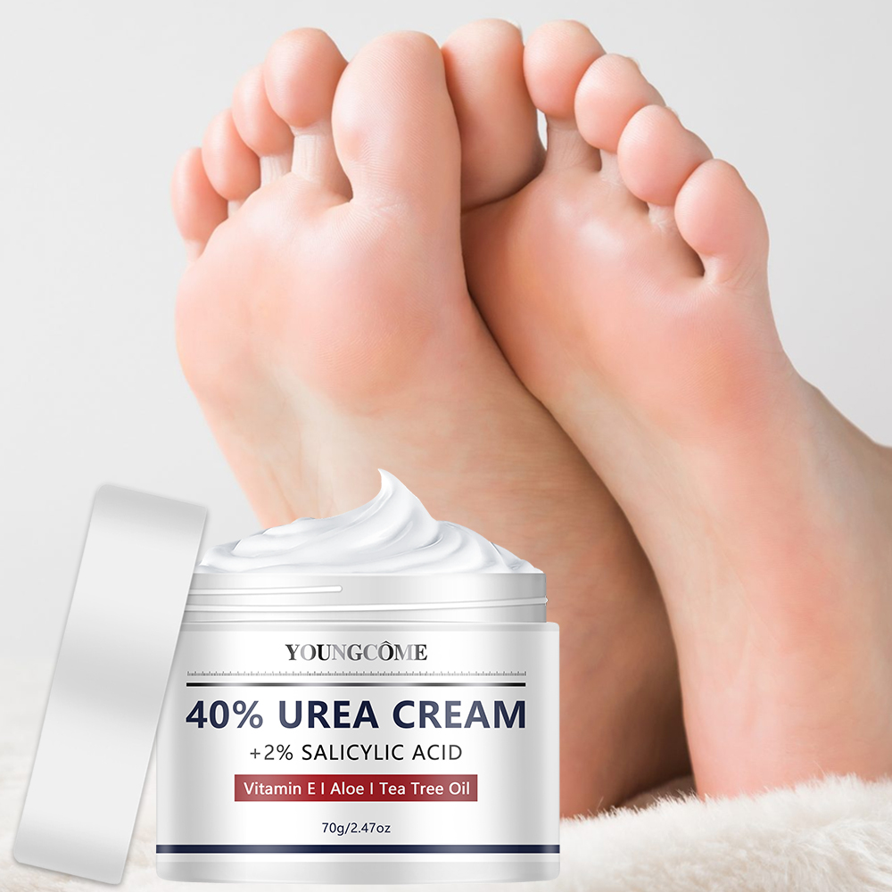 Urea-Creme für Fuß- und Handpf – Urea Foot Cream Bewertung und Preis