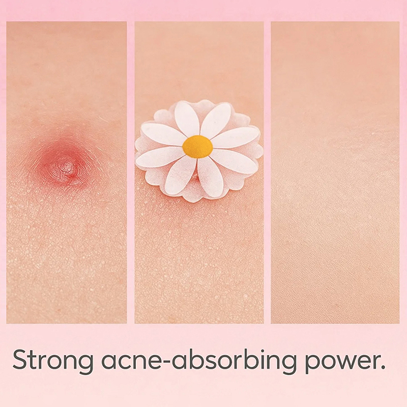 100 Stück Gesichtspflaster zur – Skincare China Bewertung und Preis